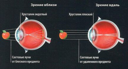 Спазм акомодації у дітей симптоми і лікування за кодом МКБ-10, як зняти обох очей