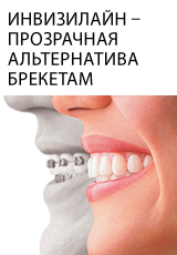 Стоматологічна клініка «стоматологія 31» пропонує якісні стоматологічні послуги,