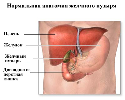 Eliminarea vezicii biliare (colecistectomie)