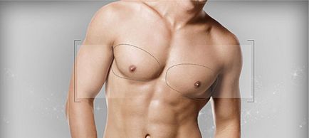 Mărirea sânilor la bărbați cu instalarea implanturilor mamare