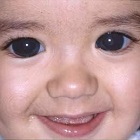 Glaucomul congenital este cel mai eficient tratament în clinica de ochi din Moscova