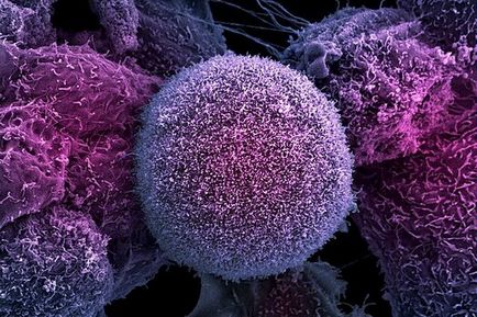 Ginseng cu boli oncologice (cancer), cercetare științifică