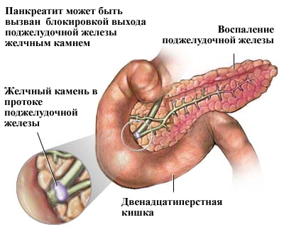 Amilaza tratamentul pancreatic este crescut - ceea ce este norma de amilaza, am văzut ceva