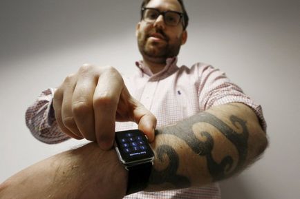 Apple karóra és bőrirritáció - tanácsadás: alma, vélemények és hírek az Apple iwatch