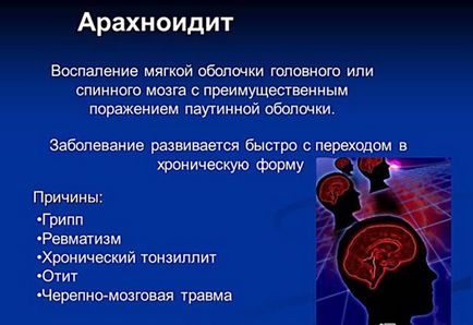Arahnoidita creierului, simptome și tratament