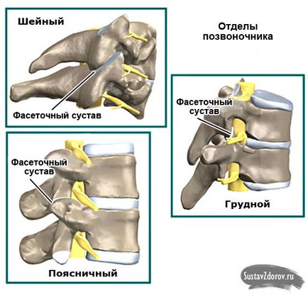 Blocada herniilor lombare