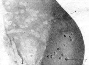 Diseases of Szarvasmarha, halál utáni változások (vér) Betegség szarvasmarha, halál utáni változások