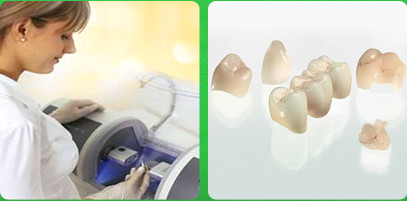 Cerec 4 стоматологічна клініка гелиос Єкатеринбург