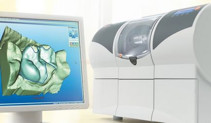 Cerec 4 clinica stomatologica helios ekaterinburg