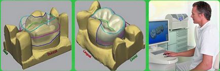 Cerec 4 стоматологічна клініка гелиос Єкатеринбург