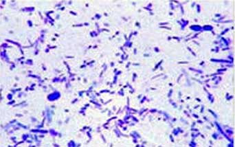 Pestis nyulak, omedvet (nyúl) nyúl pestis, omedvet