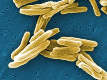 Pestis nyulak, omedvet (nyulak betegség) nyúl pestis, omedvet