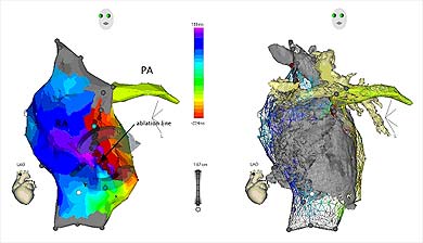 Elekrofiziologiya - Deutsches herzzentrum m - nchen