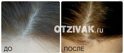 Есвіцін для волосся відгуки, результати до і після, ціни