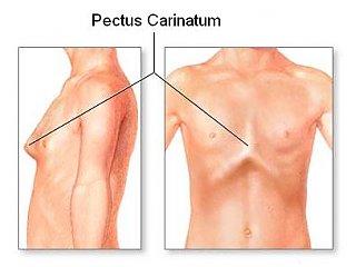 Forum disconfort părinților în hipocondrul drept, poate înfundarea hepatică de sub coaste