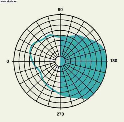 Gemianopsia medical encyclopedia