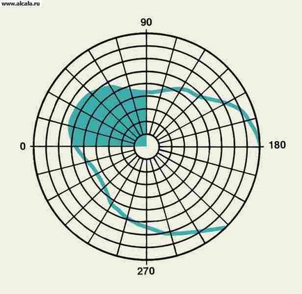 Gemianopsia medical encyclopedia