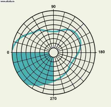 Gemianopsia medical encyclopedia