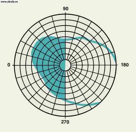 Hemianopsia Medical Encyclopedia