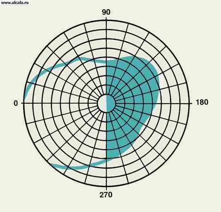 Hemianopsia Medical Encyclopedia