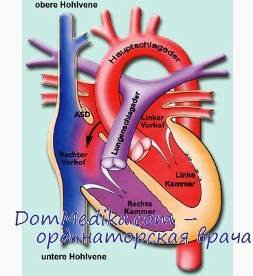 Hemodinamica cu defect septal atrial (dmp)