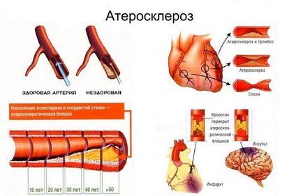 Головний біль в області скронь і чола що робити, якщо болить голова в області чола і скронь