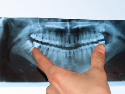 Цікаві факти, які ви не знали про зубах