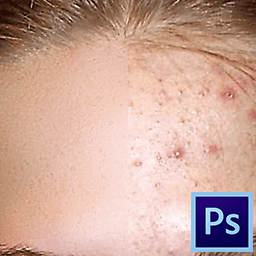 Cum se elimină acneea în Photoshop