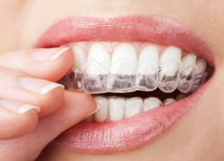Як зміцнити емаль зубів