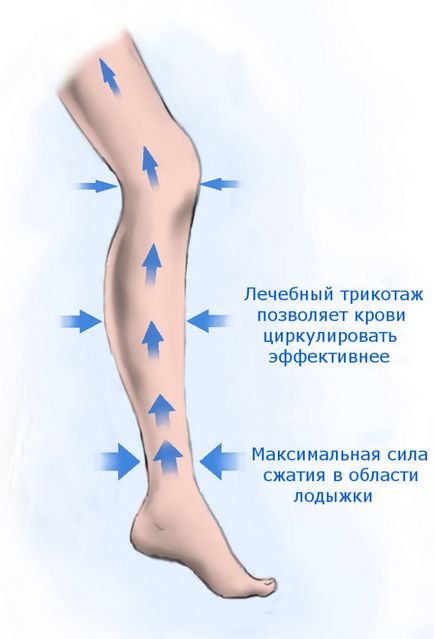 Компресійну білизну при варикозі