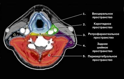 Tomografia computerizată a gâtului și pregătirea examenului