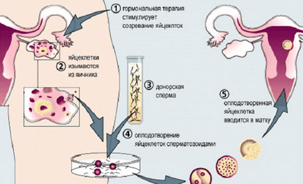 Короткий протокол еко по днях детально