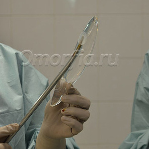 Kroproplastie (picioarele din plastic, operație pentru creșterea stării) - înainte și după fotografii, recenzii, clinici