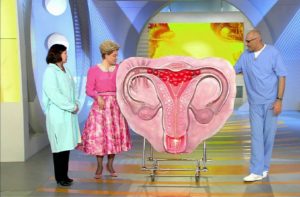 Tratamentul fibromilor uterini în mod inovator în Israel