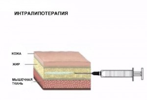 Ліполітікі відгуки, властивості, особливості застосування