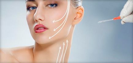 Mezoniti pentru facelift (tredlifting)