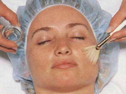 Мигдальний пілінг для обличчя відгуки, опис процедури, її плюси і мінуси