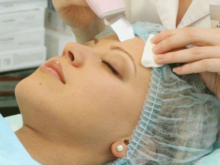Peeling de migdale pentru examinarea feței, descrierea procedurii, avantajele și dezavantajele acesteia