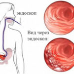 Mucosa compositum használati utasítást, ár, áttekintésre, analógok