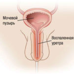 Mukoza compositum instrucțiuni de utilizare, preț, recenzii, analogi