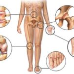 Mukoza compositum instrucțiuni de utilizare, preț, recenzii, analogi