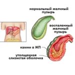 Mucosa compositum használati utasítást, ár, áttekintésre, analógok