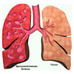 Mucosa compositum használati utasítást, ár, áttekintésre, analógok