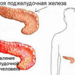 Mucosa compositum használati utasítást, ár, áttekintésre, analógok