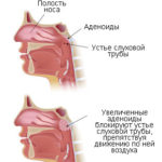 Mukoza compositum instrucțiuni de utilizare, preț, recenzii, analogi