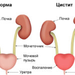 Mukoza compositum instrucțiuni de utilizare, preț, recenzii, analogi