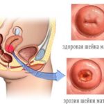 Mukoza compositum instrucțiuni de utilizare, preț, recenzii, analogi