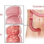 Mukoza compositum instrucțiuni de utilizare, preț, recenzii, analogi