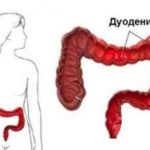 Mucosa compositum használati utasítást, ár, áttekintésre, analógok