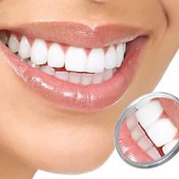 A varázsa a mosoly, így oxigénes fehérítő a klinikán „Dental-látogatás” metro „Belyaevo”